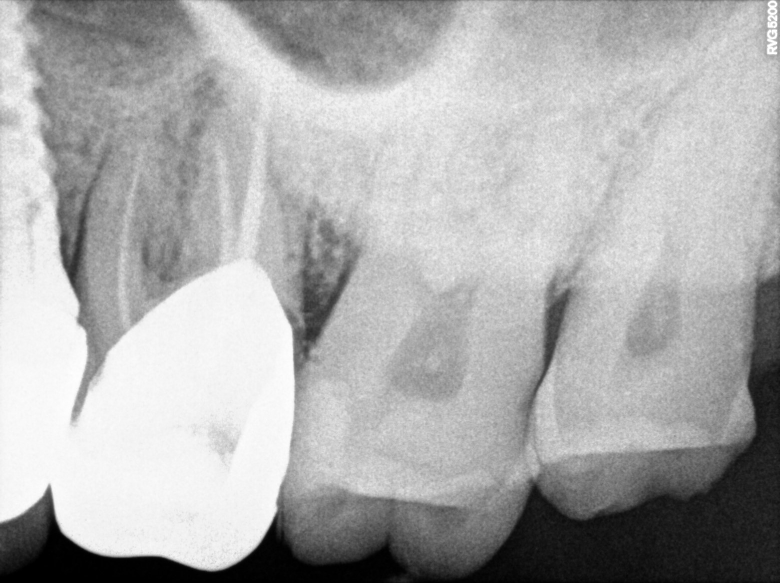 Dental X-ray
